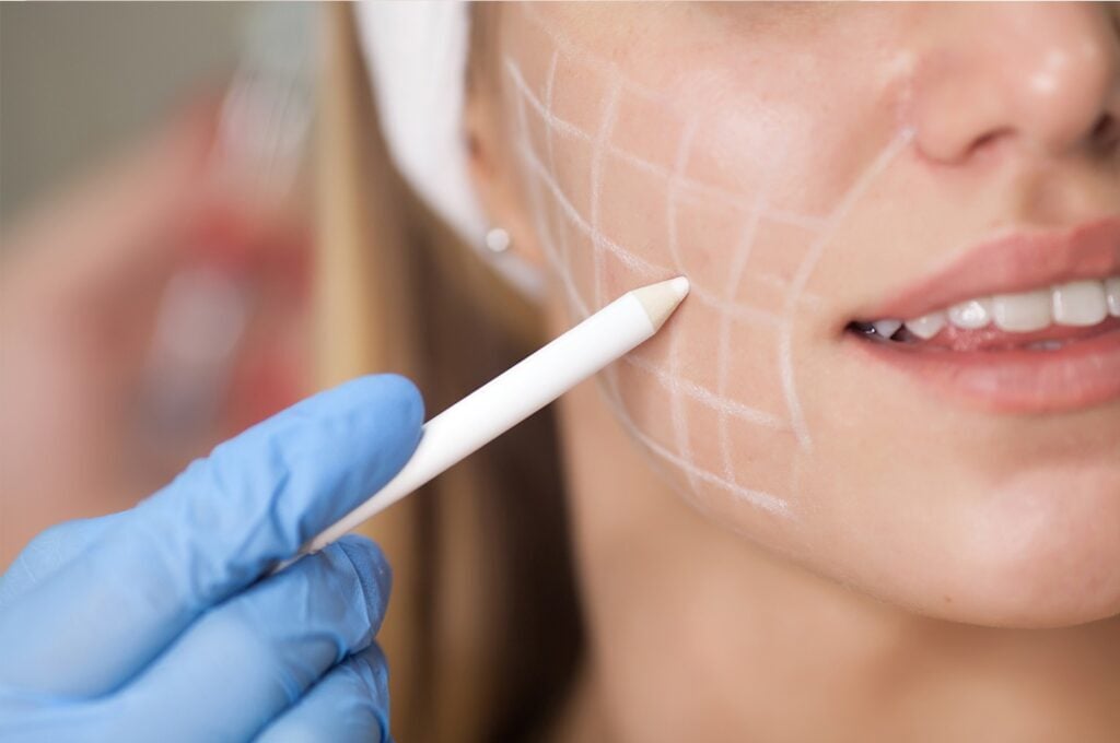 Cara menghilangkan Botox di wajah – penjelasan dari ahli bedah plastik